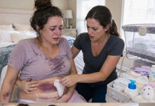 “Please… don’t press too hard near the C-section stitches,” my sister whispered while I helped change her postpartum bandages. But when I lifted the gauze, my hands froze. A huge boot-shaped bruise covered the fresh, bleeding incision. Her voice broke as she said, “He got angry because I made his coffee too slowly this morning.” Her tears fell while milk soaked through her shirt, and in that silent moment, I made a promise: he would lose everything.